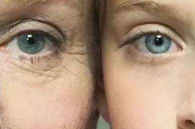 肌膚粗糙如何改善