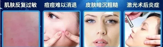 醫(yī)用冷敷貼適用的膚質(zhì)人群