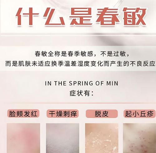 春敏是什么？如何有效預(yù)防春敏？